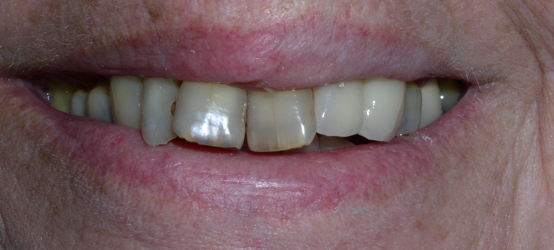 Before